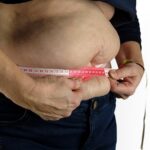 Quel est l’objectif de la chirurgie de la sleeve gastrique ?