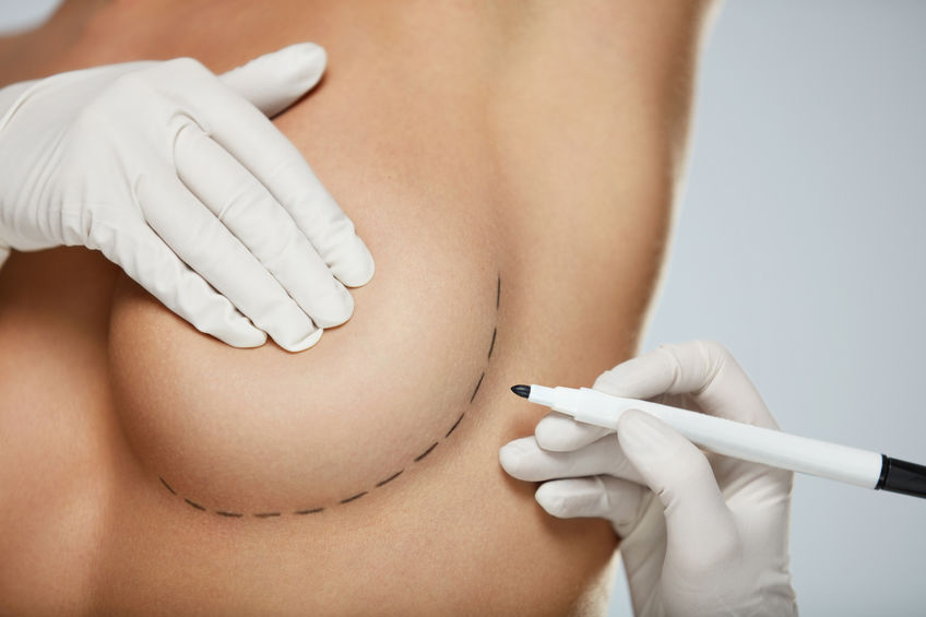 Soins après une augmentation mammaire : conseils d’experts !